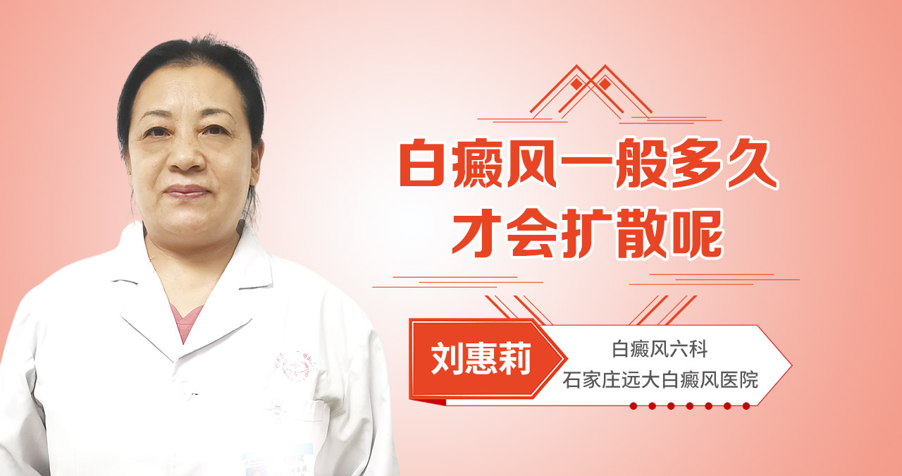 白癜风一般多久才会扩散呢